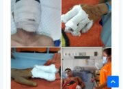 Wow.. Wartawan Korban Disiram Air Keras, Kini Jadi Terlapor?