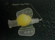 Abocath Yang Putus Tak Ditemukan Di Tangan Anaknya Oleh dr. OY, Akhirnya  Herry Lapor Polisi