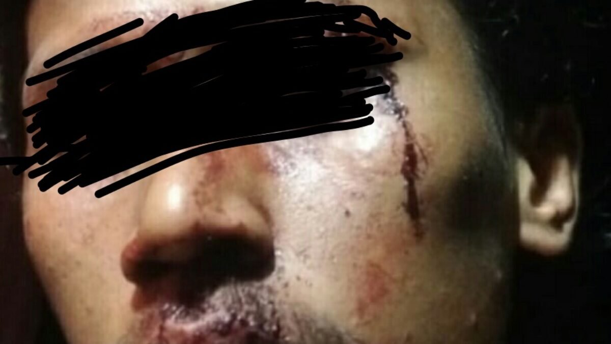 Korban Harapkan Pelaku Penganiaya Terhadap Dirinya Segera Ditangkap