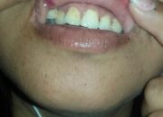 Trauma Dianiaya Suami, Polres Tobasa Diminta Serius Dalam Penanganan