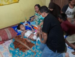 Feri Ferdiwijaya Bocah Sembilan Tahun Desa Banjarsari Korban Luka Bakar Butuh Perhatian Serius Pemkab Bekasi